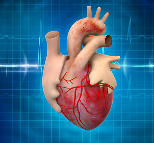 Heart Attack: Causes, Symptoms, Prevention, and Treatment
